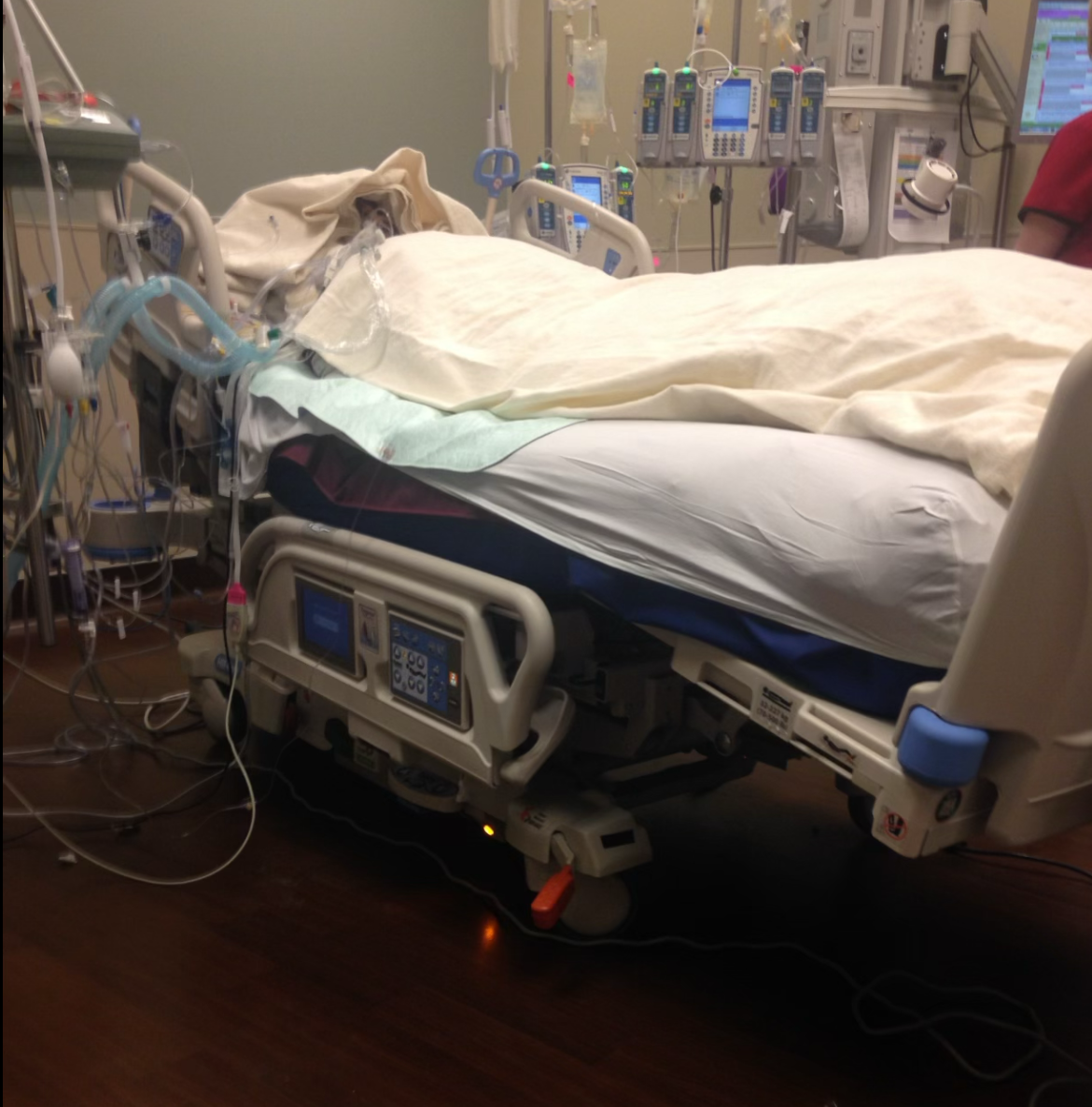 ICU hospital bed with medical equipment during Jessica's critical care stay